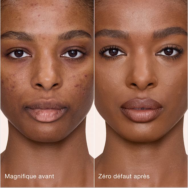 Avant/après Airbrush Flawless Concealer - 13 Deep (Foncé) Comparaison côte à côte de la peau avant et après l'application de l'Airbrush Flawless Concealer de Charlotte Tilbury, avec les étiquettes de texte « Magnifique avant » et « Zéro défaut après ».