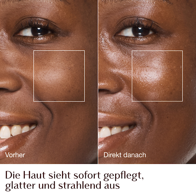 Magic Cream – Vorher-Nachher-Bilder von Feuchtigkeitspflege – Model Mandy Magic Cream – Vorher-Nachher-Bilder von Feuchtigkeitspflege – Model Mandy