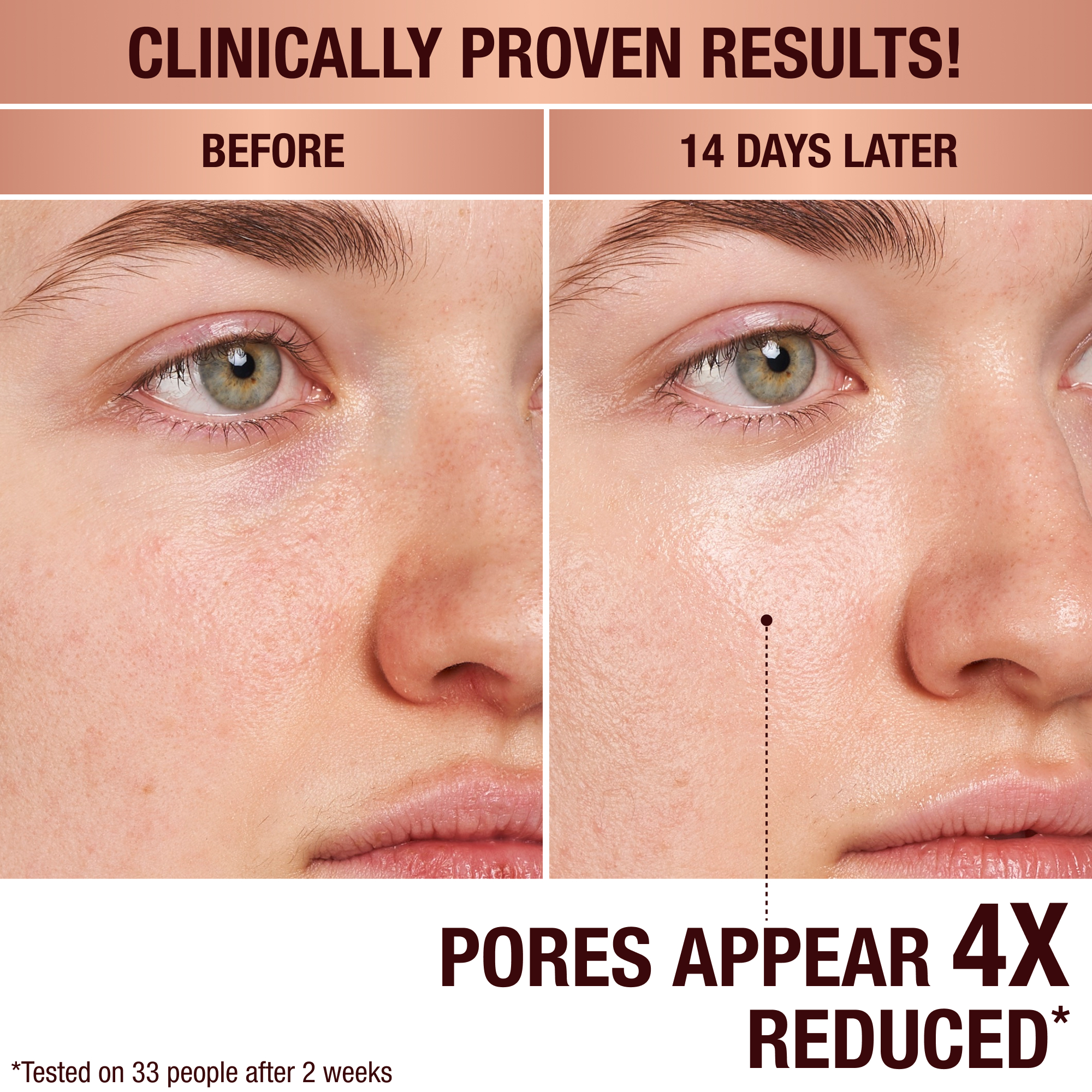 Clinically proven results. Pores appear 4 times reduced. Tested on 33 people after 2 weeks.