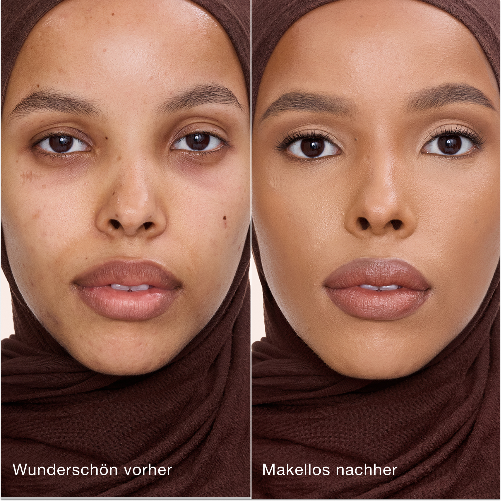 Ein direkter Vergleich zeigt die Haut vor und nach dem Auftragen des Charlotte Tilbury Airbrush Flawless Concealers mit den Beschriftungen „Wunderschön vorher“ und „Makellos nachher“.
