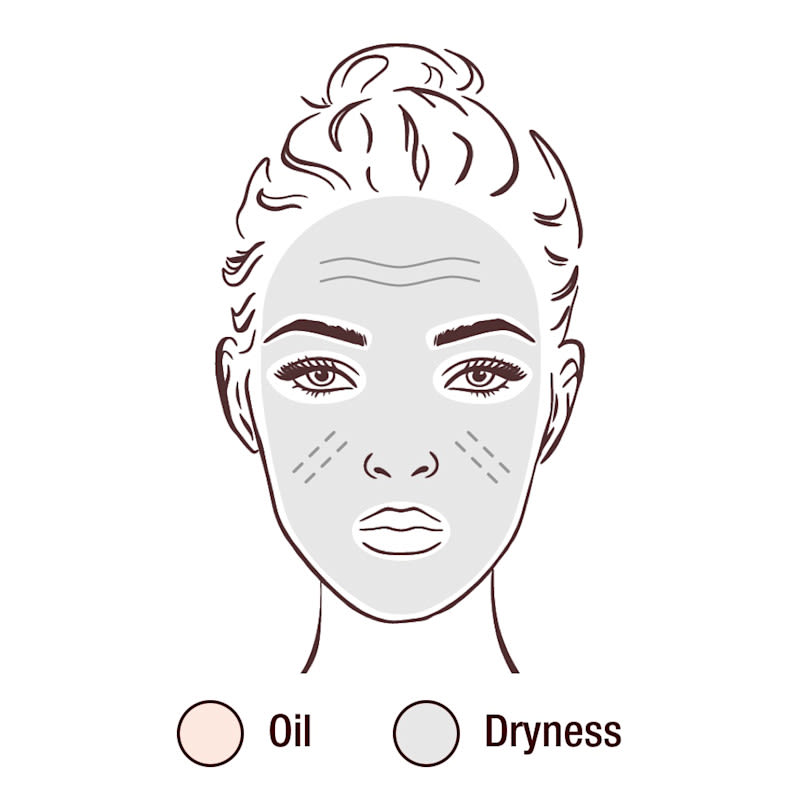 Rostro ilustrado con color gris para representar la sequedad, además de líneas y textura
