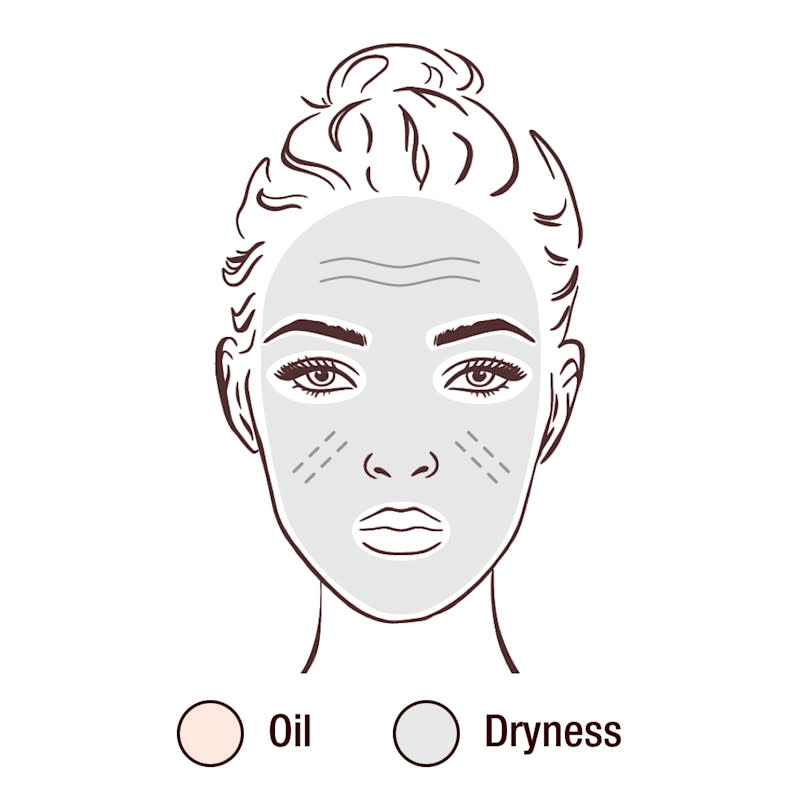 Rostro ilustrado con color gris para representar la sequedad, además de líneas y textura