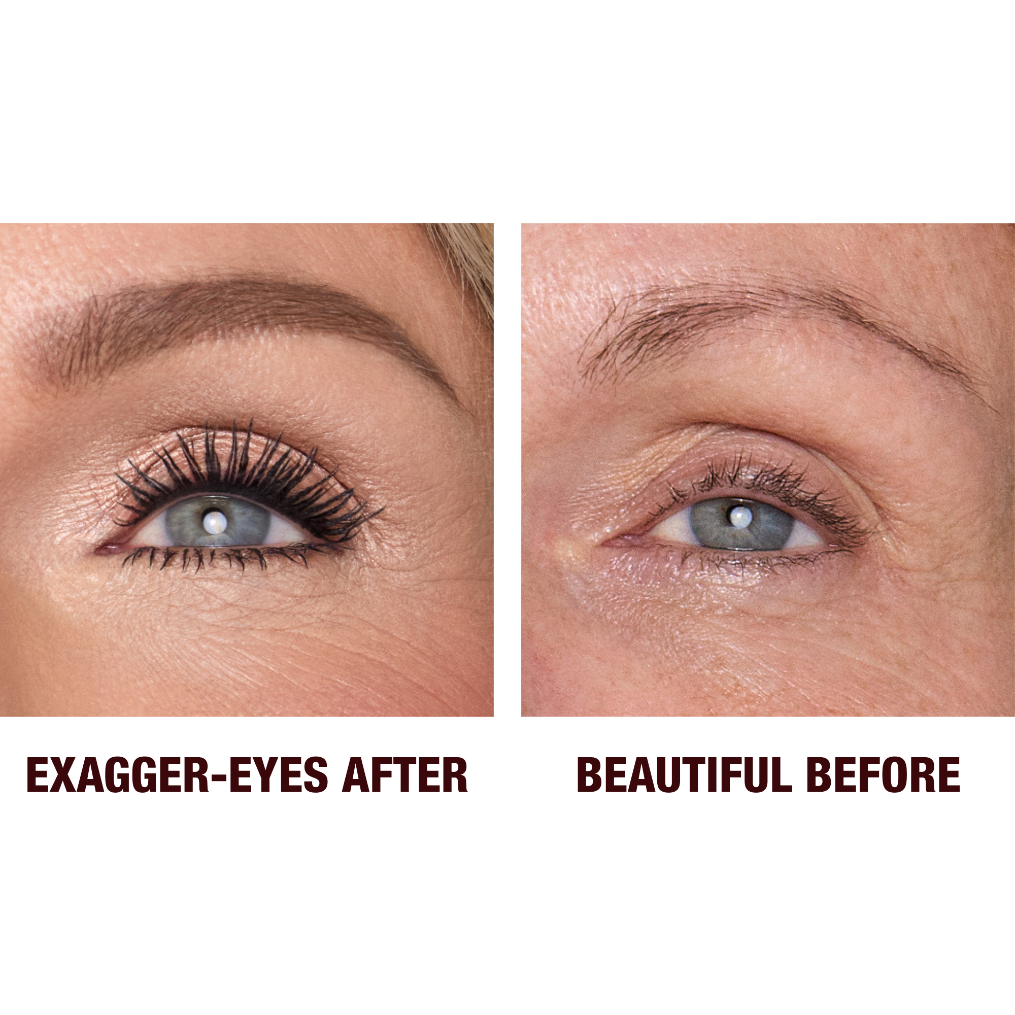 Exagger-Eyes before and after