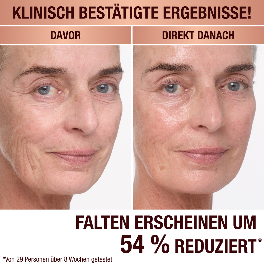 Anwendung der Magic Cream auf einem Model vor und nach der Anwendung