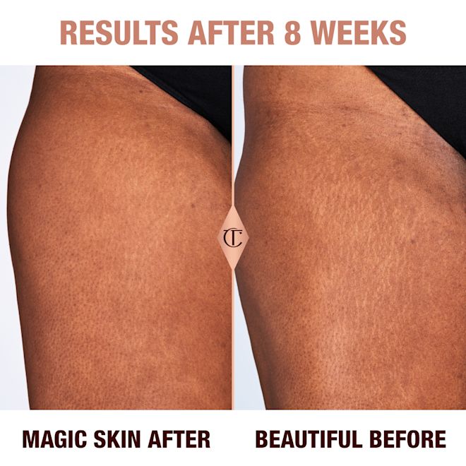 Results of Magic Body Cream after 8 weeks on a deep skin model Results of Magic Body Cream after 8 weeks on a deep skin model