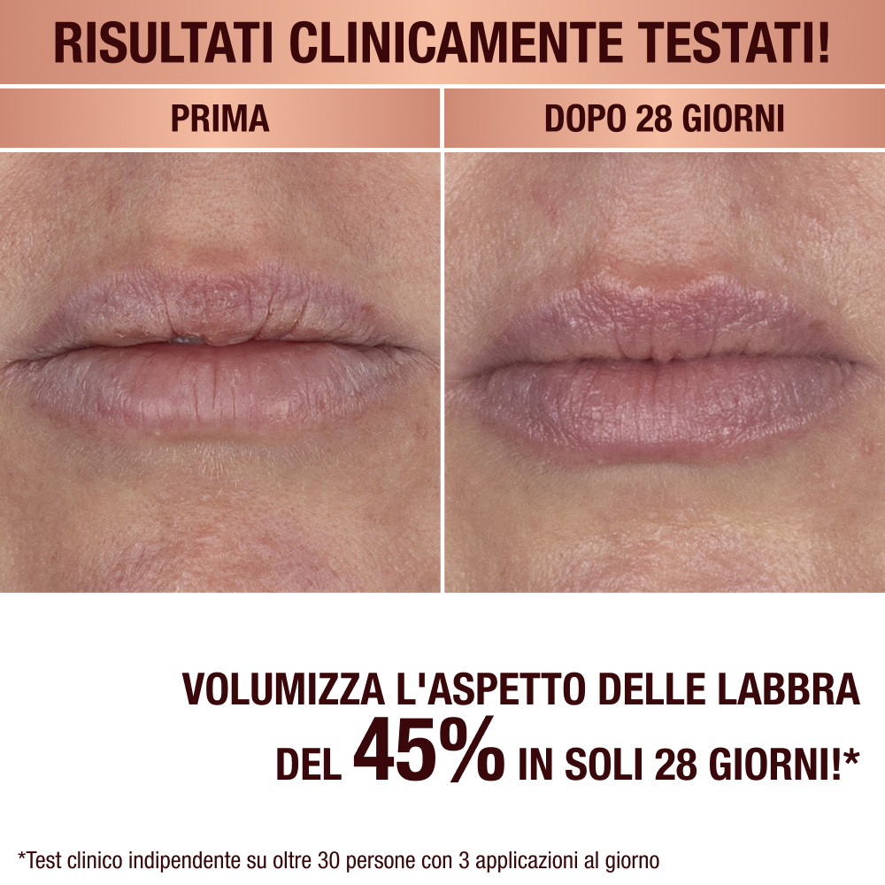 Lip Mask prima e dopo