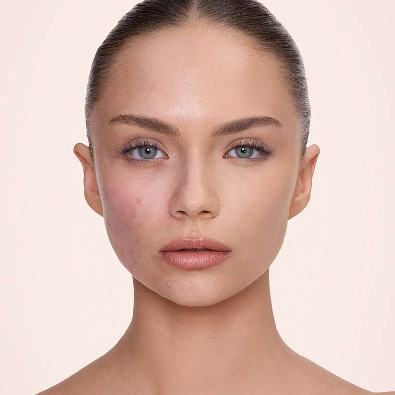 How to cover redness with makeup before and after