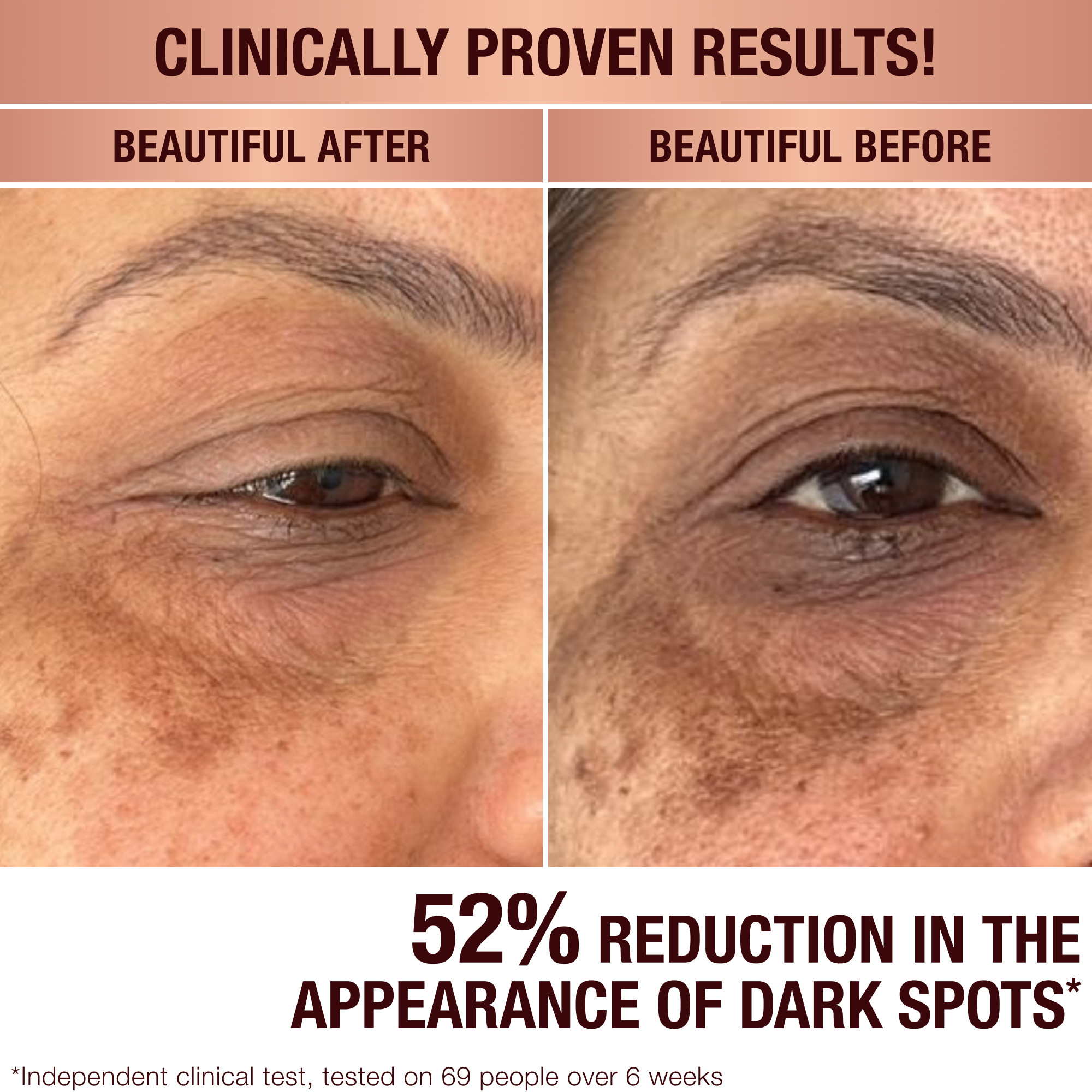 Charlotte Tilbury Dark Spot Correcting Radiance Recovery Serum - 10 ml