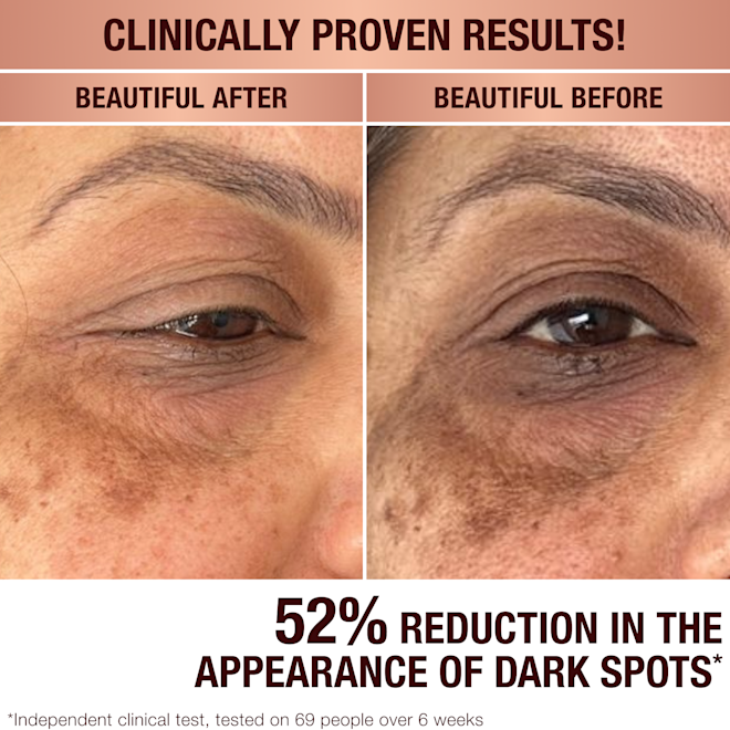 Charlottes Dark Spot Serum Charlottes Dark Spot Serum