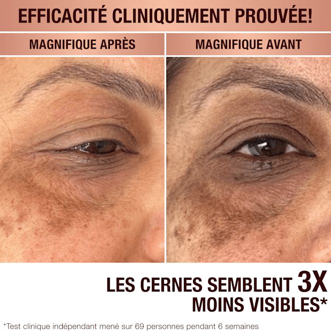 Sérum anti-taches brunes de Charlotte Sérum anti-taches brunes de Charlotte