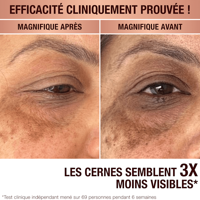 Sérum anti-taches brunes de Charlotte Sérum anti-taches brunes de Charlotte