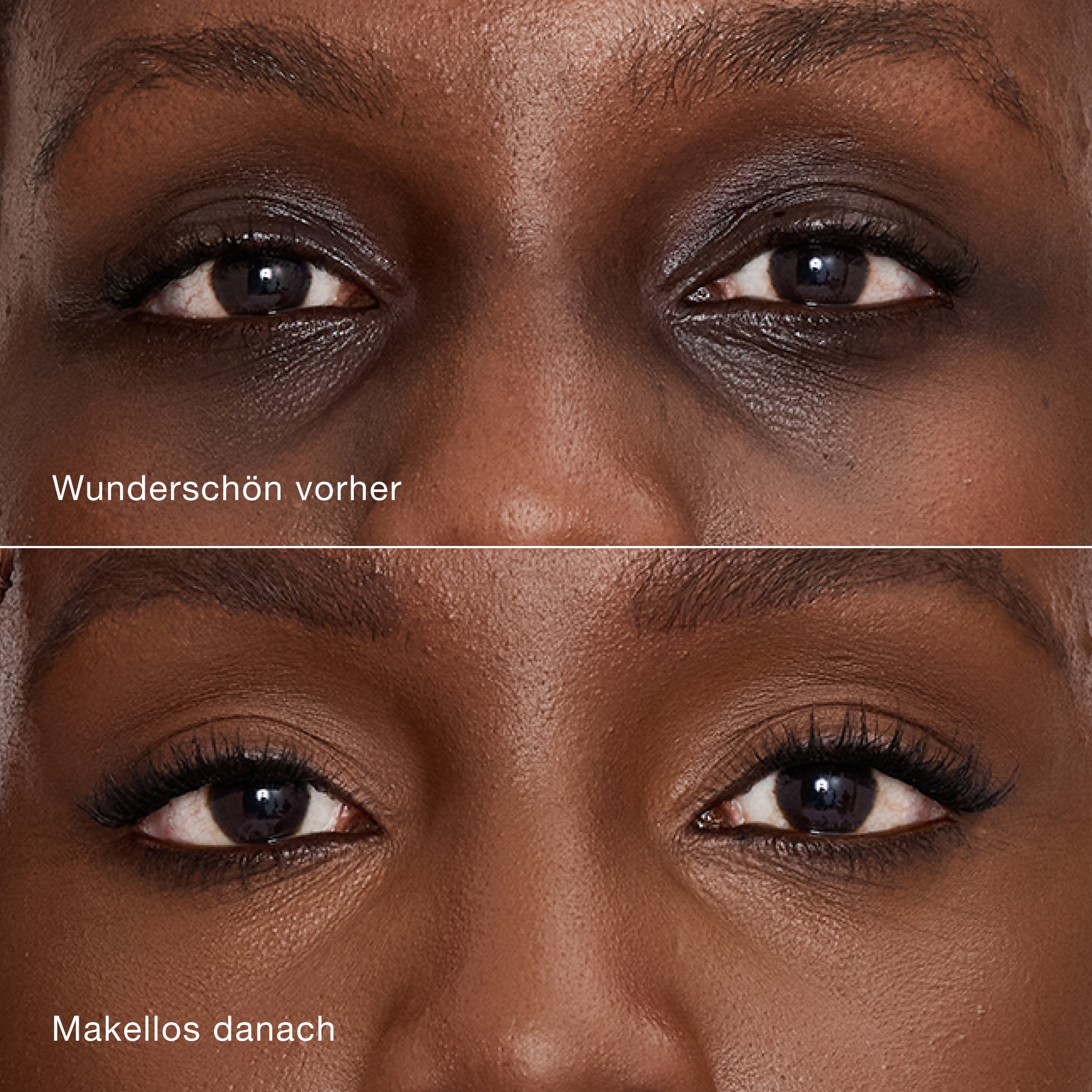Nahaufnahme-Vergleich der Haut vor und nach dem Auftragen des Charlotte Tilbury Airbrush Flawless Concealers, der eine verbesserte Deckkraft und ein glattes Finish demonstriert.