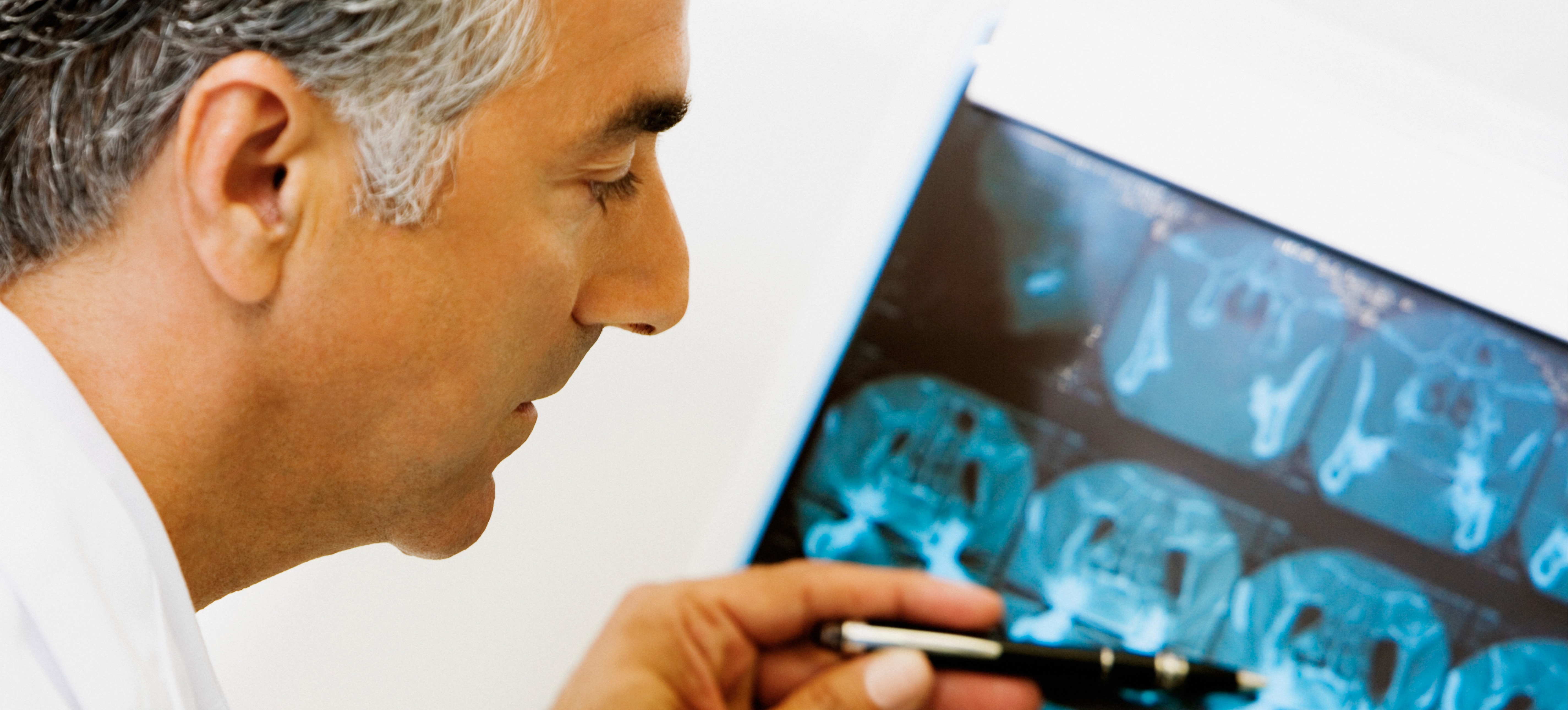 [Featured Image]: A doctor analyzing a scan highlights the impact of deep learning and neural networks on medical imaging technology and diagnostics. 
