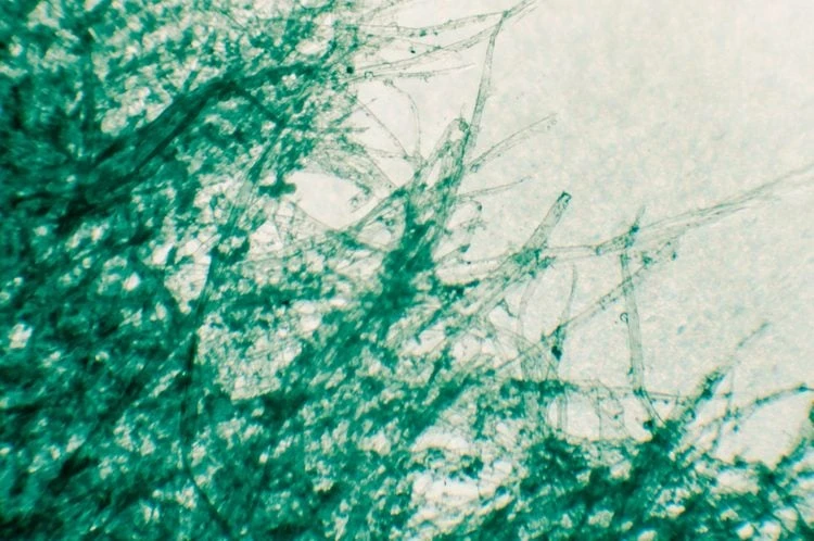 Torn paper - microscopic, Nosyrevy