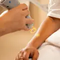 Laser hair removers
