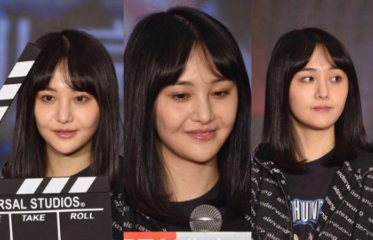 Zheng Shuang's Plastic Surgery Still Under Fire by Netizens | Hotpot TV