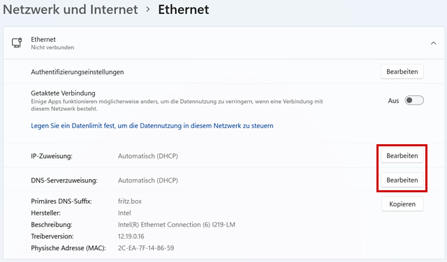 Ansicht Ethernet: Bearbeiten unter IP-Zuweisung, DNS-Serverzuweisung hervorgehoben