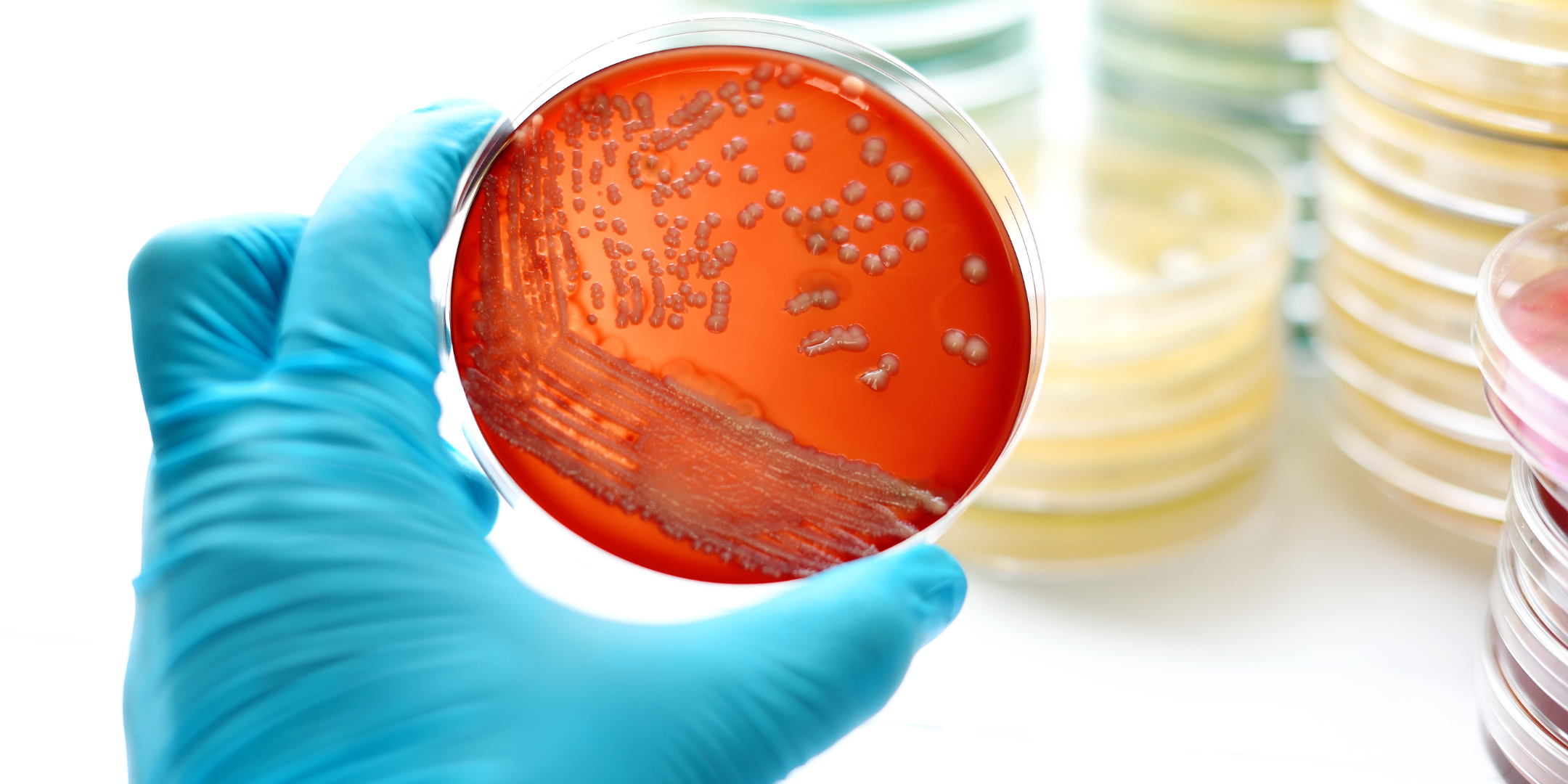 An agar plate with streaks of bacteria held by a gloved hand