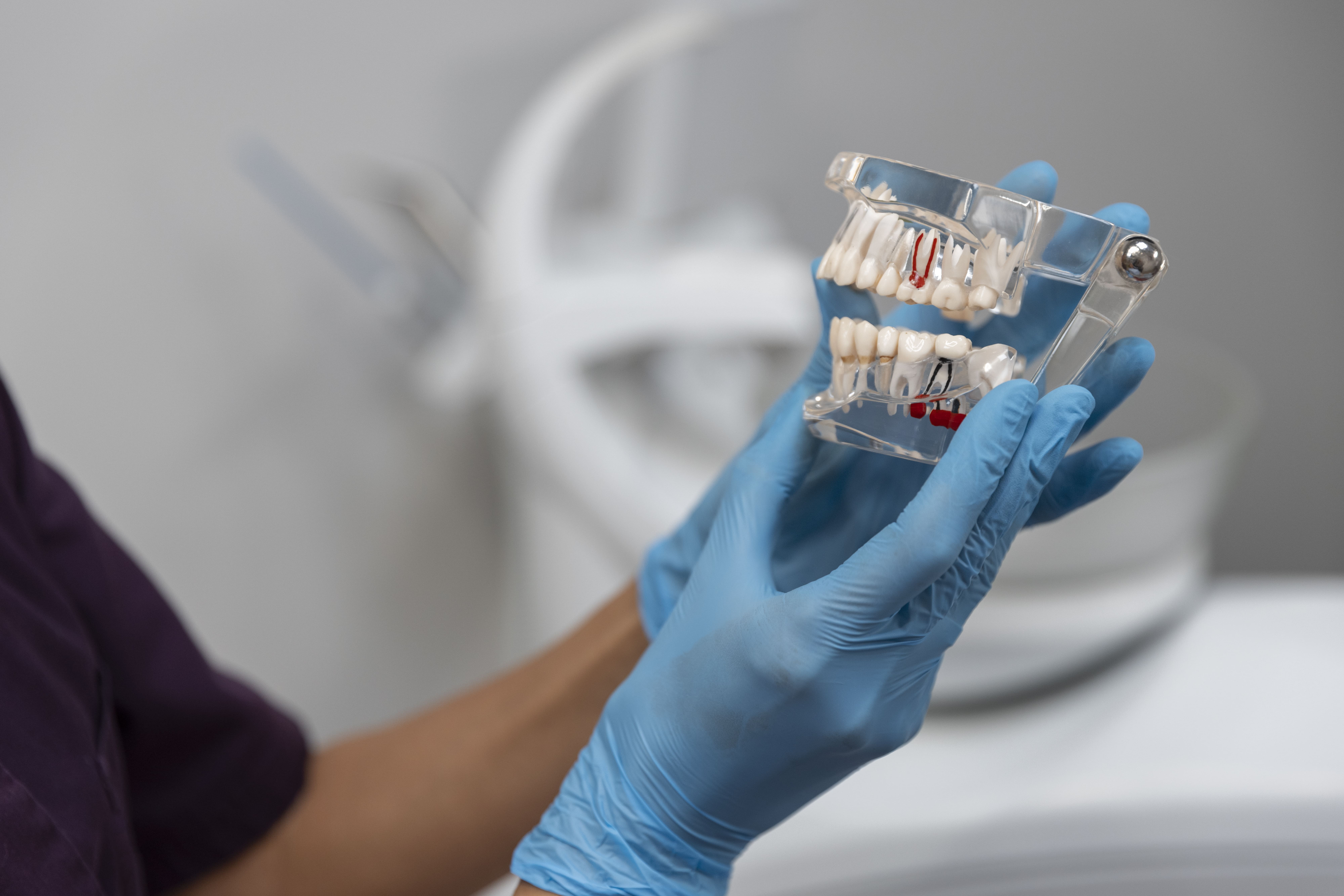 Carga inmediata dental: cómo llevarte una boca nueva en 24 horas
