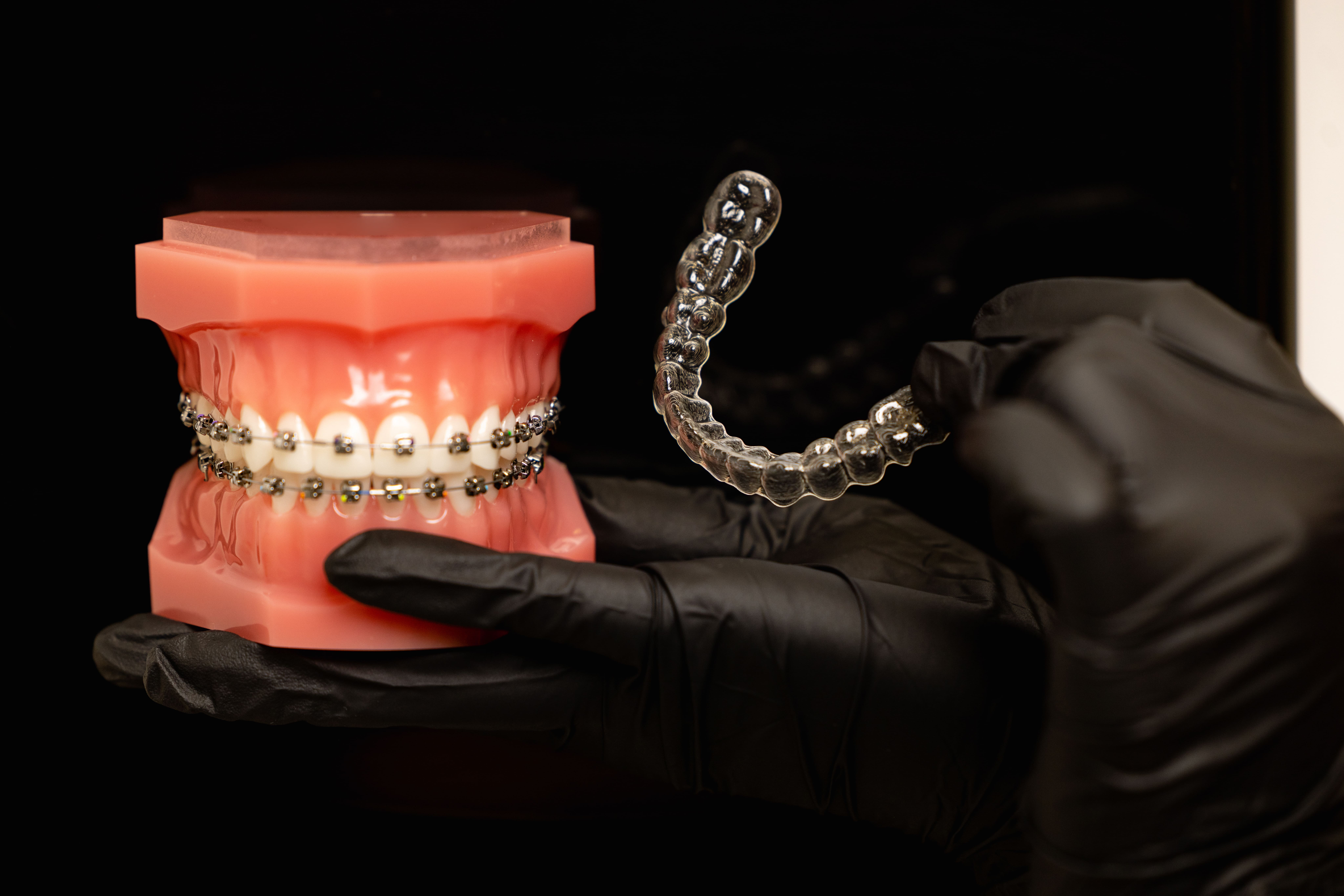 Brackets o Invisalign: cómo elegir la ortodoncia que mejor te encaja