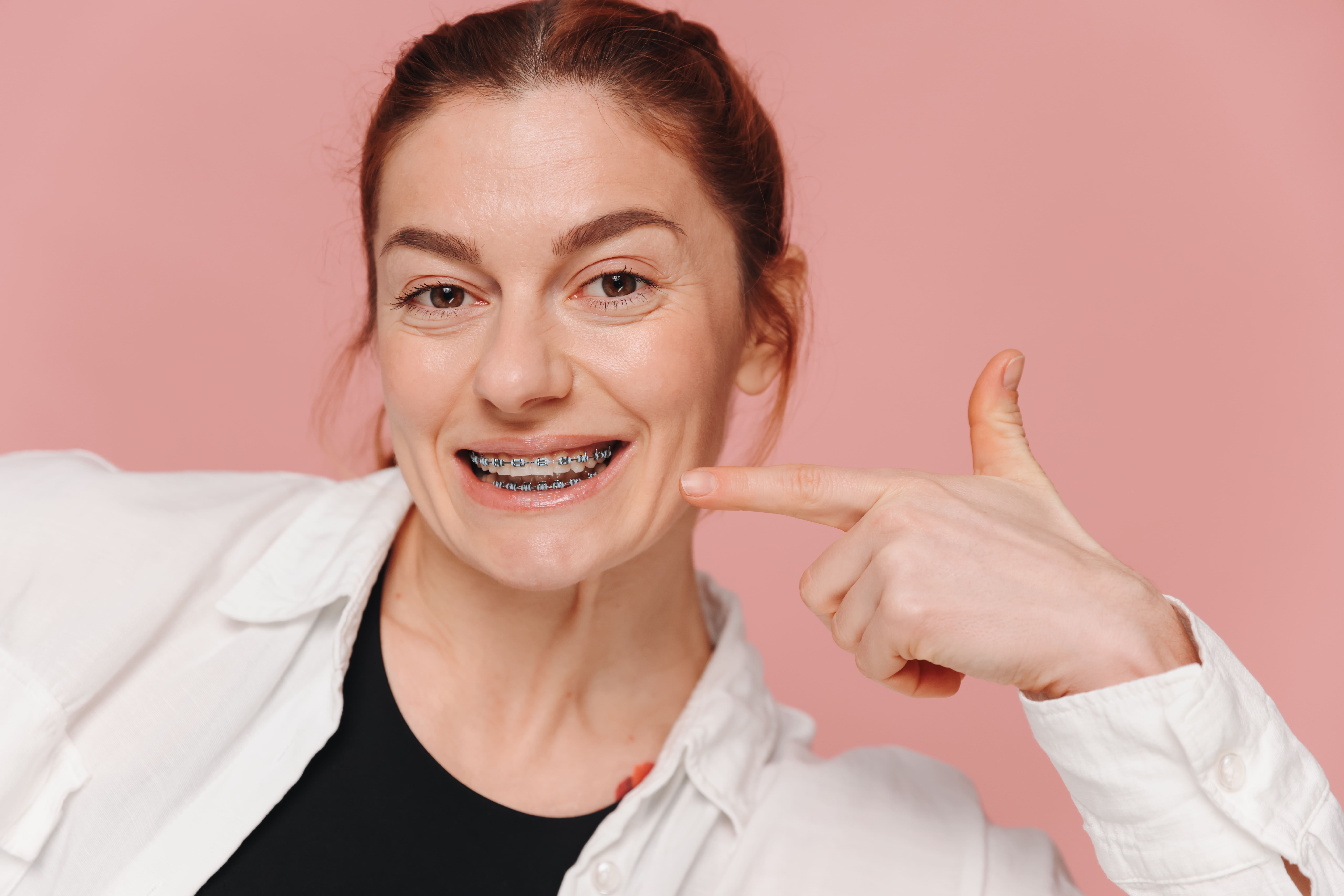 Ortodoncia para adultos: ¿merece la pena ponerse brackets a los 40?