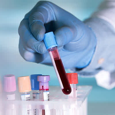 Private Blood Tests