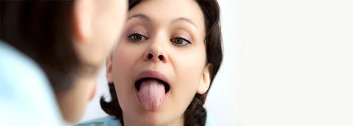 Zungenreiniger sind eine Option gegen Halitosis 