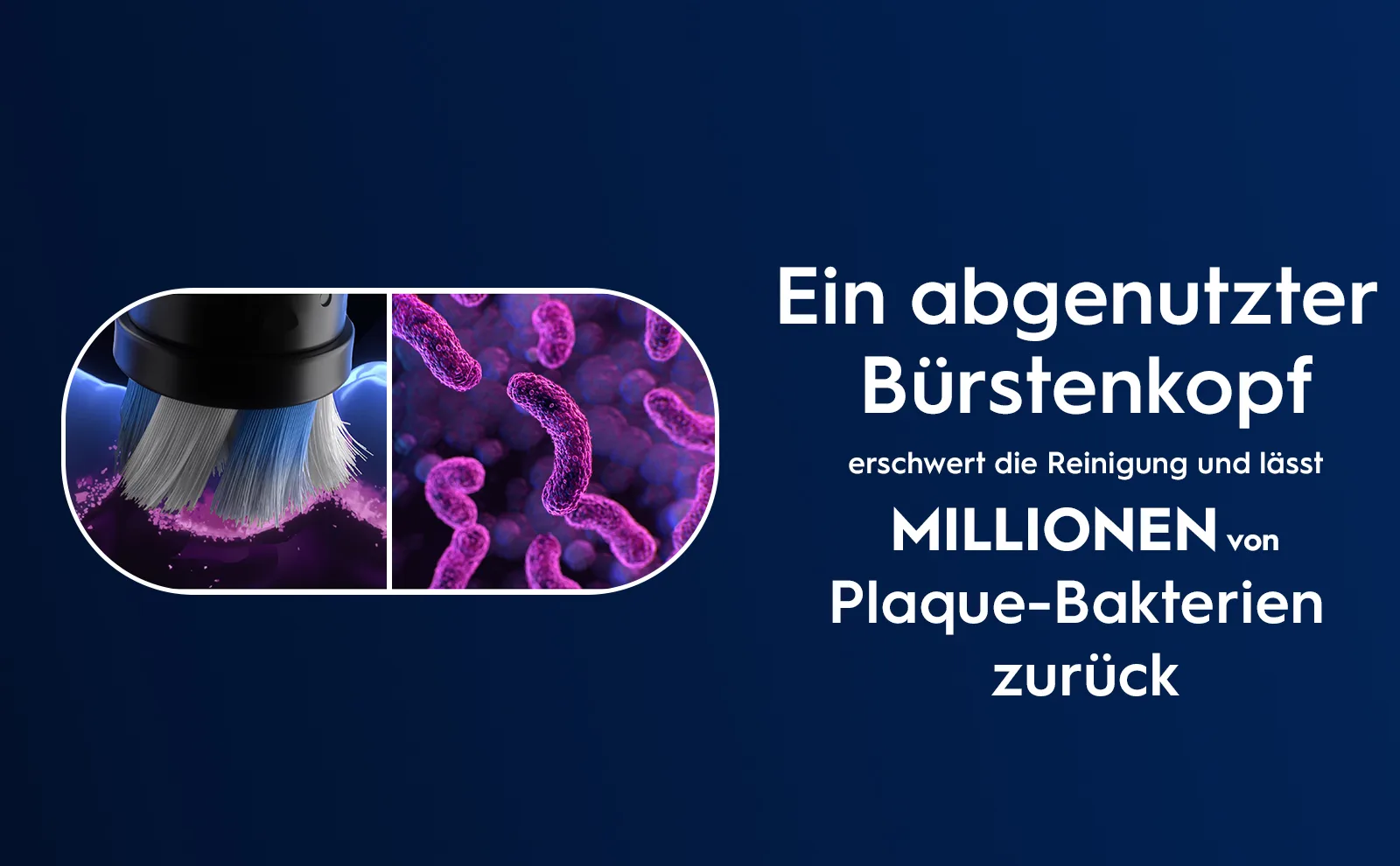 Nahaufnahme von Plaque-Bakterien, die mit abgenutztem Bürstenkopf nur schwer zu entfernen sind. 