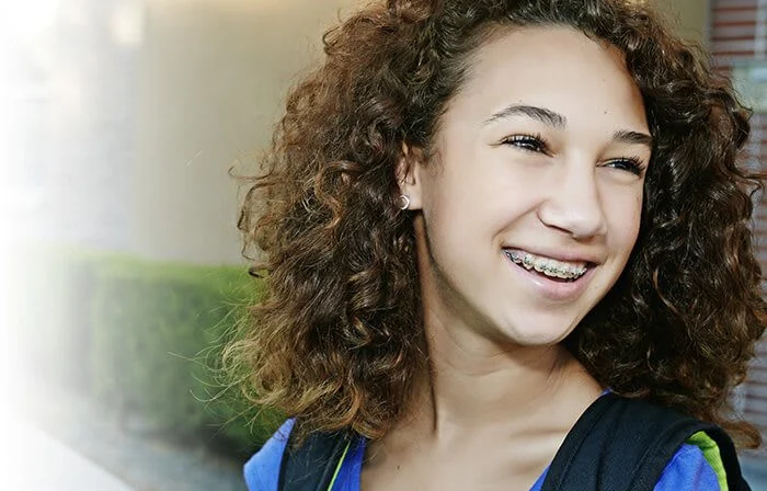 Zahnspangen – die optimale Zahnpflege erreichen