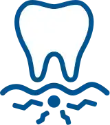 Plaque-Aufbau am Zahnfleischrand  undefined