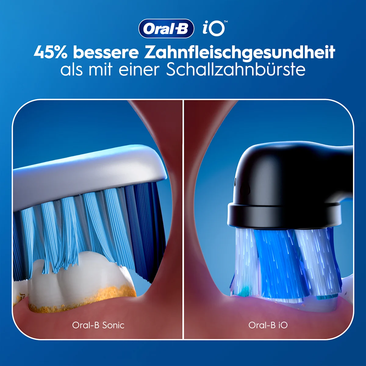 Oral-B iO3 Verpackung mit dem Hinweis auf 360° visuelle Andruckkontrolle und der Auszeichnung Testsieger von Stiftung Warentest.