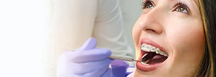 Zahnspangen-Behandlungen: Das erwartet Sie bei der Untersuchung article banner