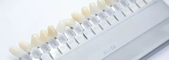Erwartungen, die Sie an Veneers haben können