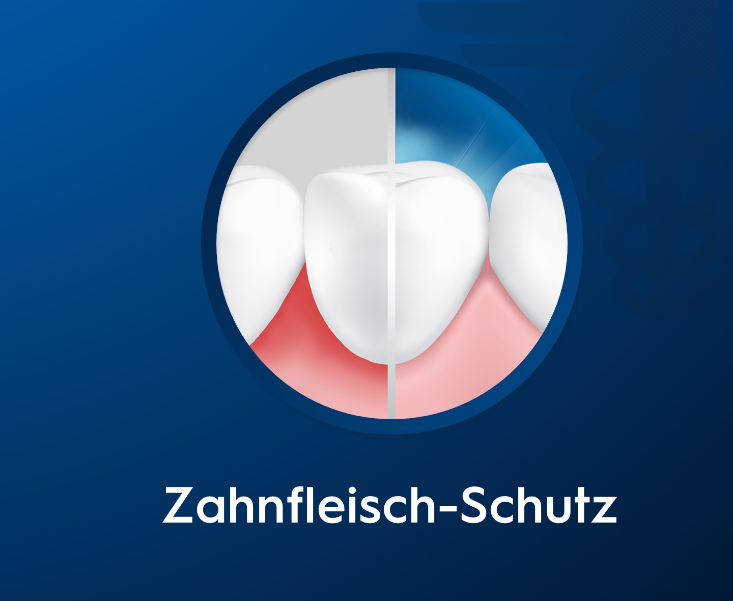 Zahnfleisch-Schutz