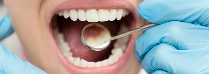 Sind Zahnimplantate schmerzhaft? article banner