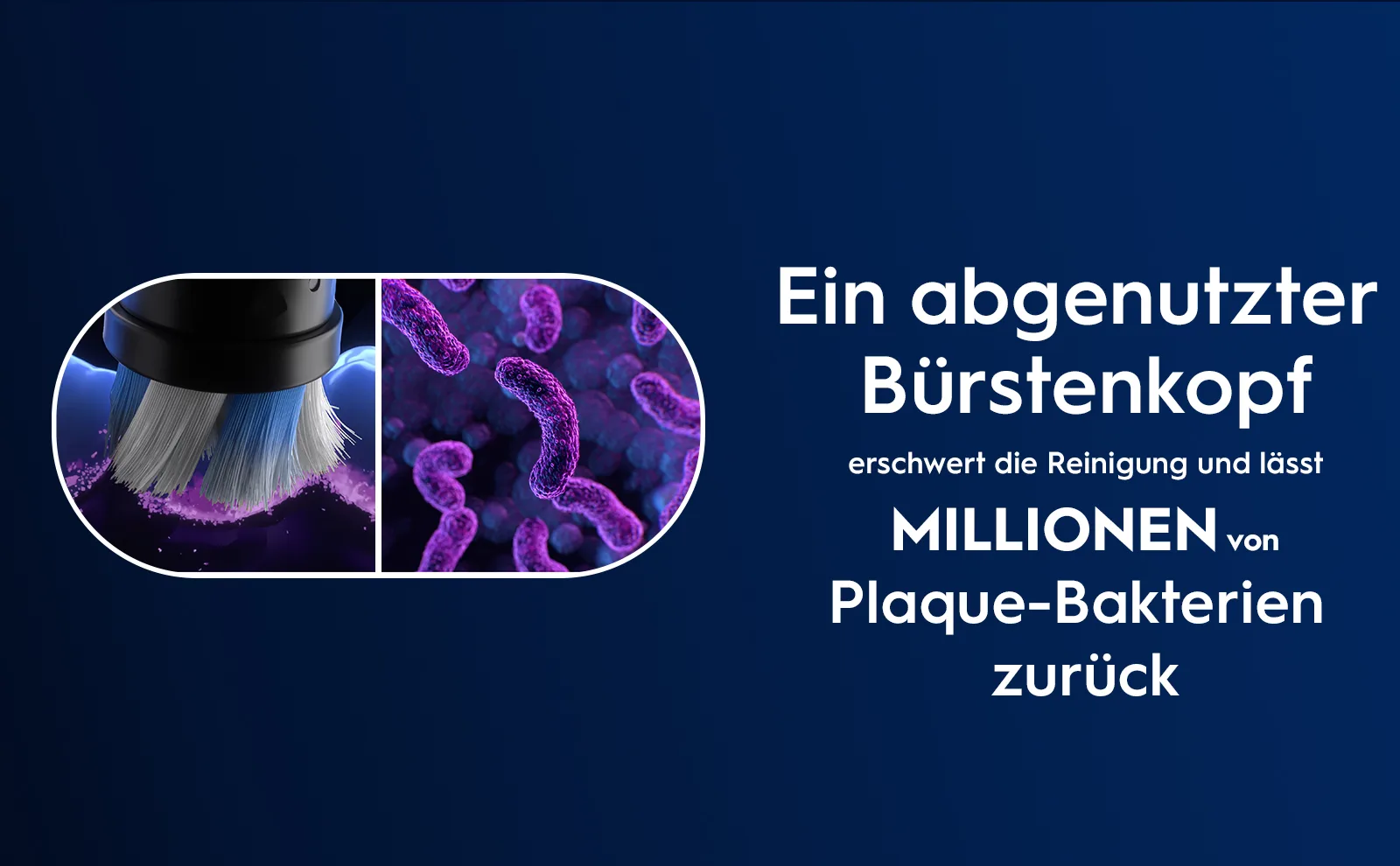 Nahaufnahme von Plaque-Bakterien, die mit abgenutztem Bürstenkopf nur schwer zu entfernen sind. 