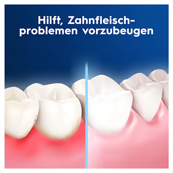 Oral-B Pro-Expert Advanced Zahnseide, Verpackung mit dem Hinweis "Entfernt Plaque-Bakterien" und "Tiefen-Reinigung Frische Minze".