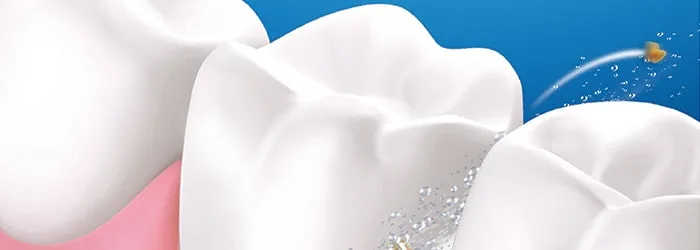 Munddusche oder Zahnseide - Was ist besser? 