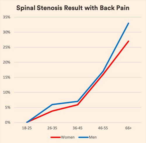 Spinal-Stenosis-Result.jpg