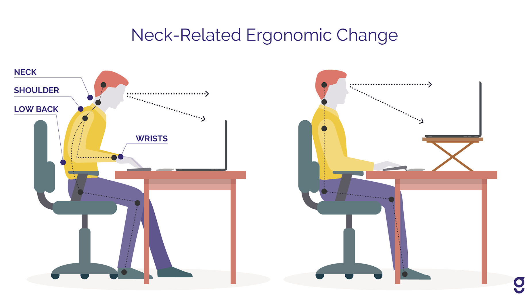 Screen Neck What Is Tech Neck?