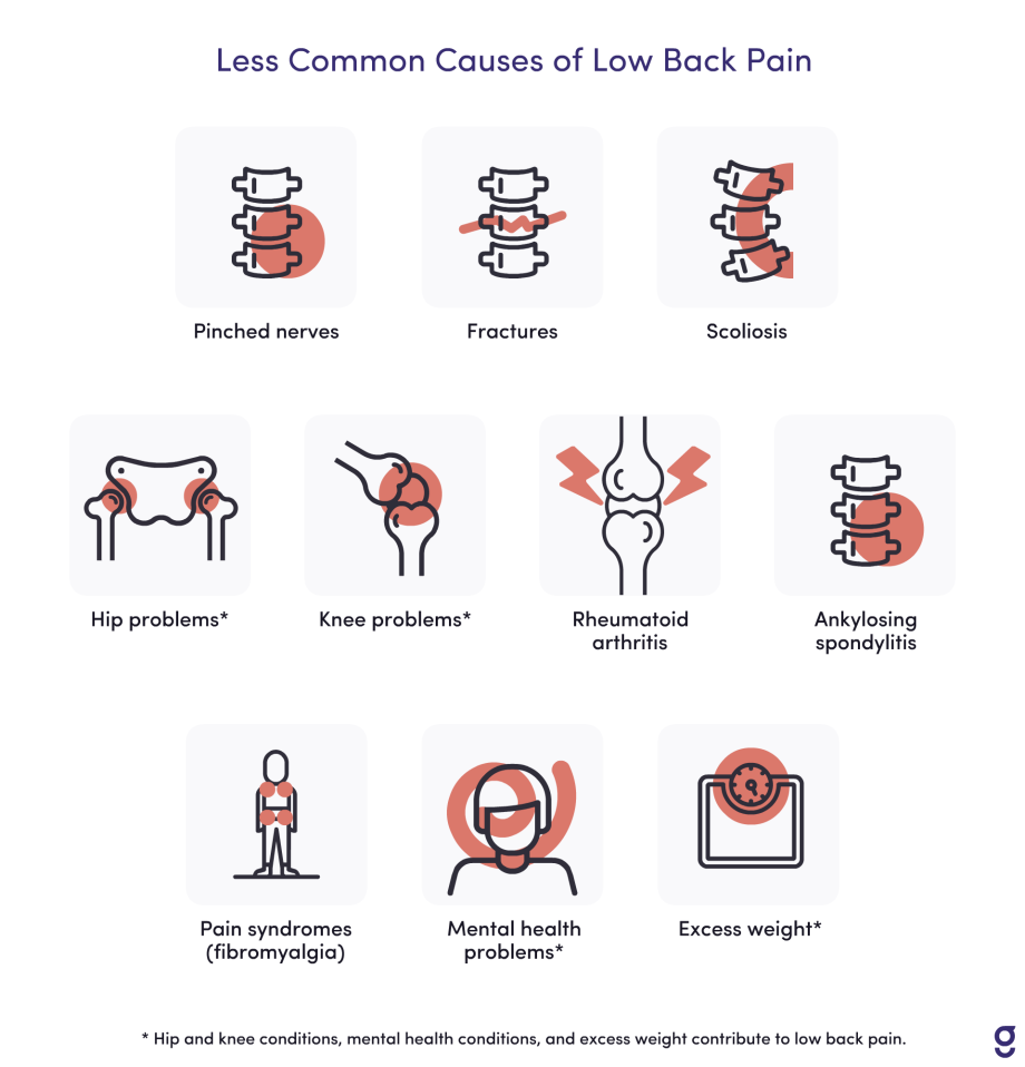 10 Common Causes of Low Back Pain