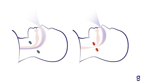 What's the Difference Between Snoring and Sleep Apnea? | Goodpath