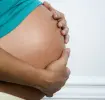 Stretch Marks during Pregnancy