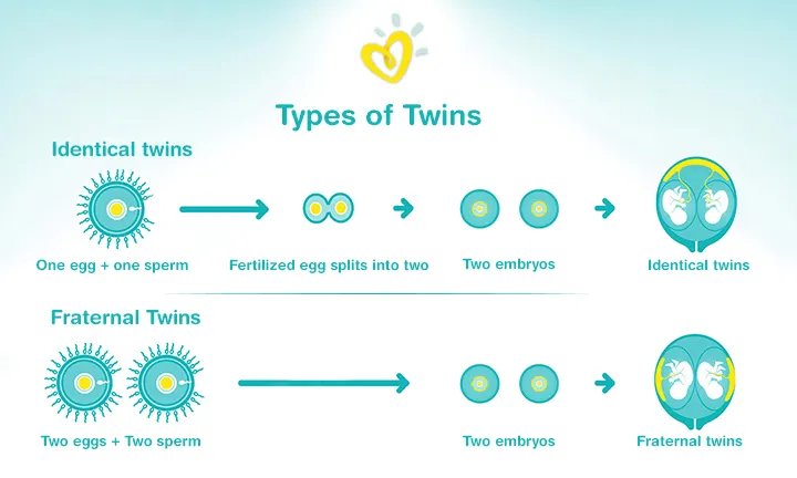 Types of Twins in Mother’s Womb
