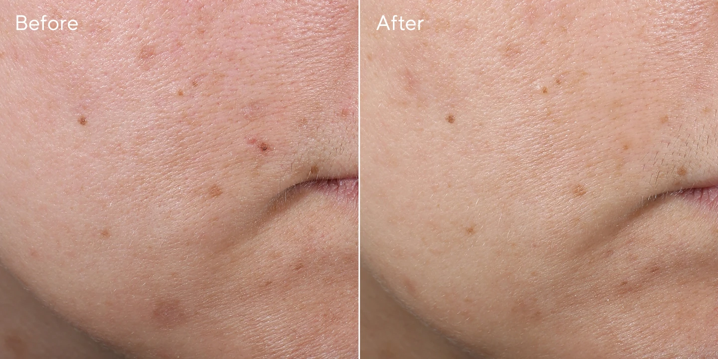 Rapid Age Spot Correcting Serum Murad