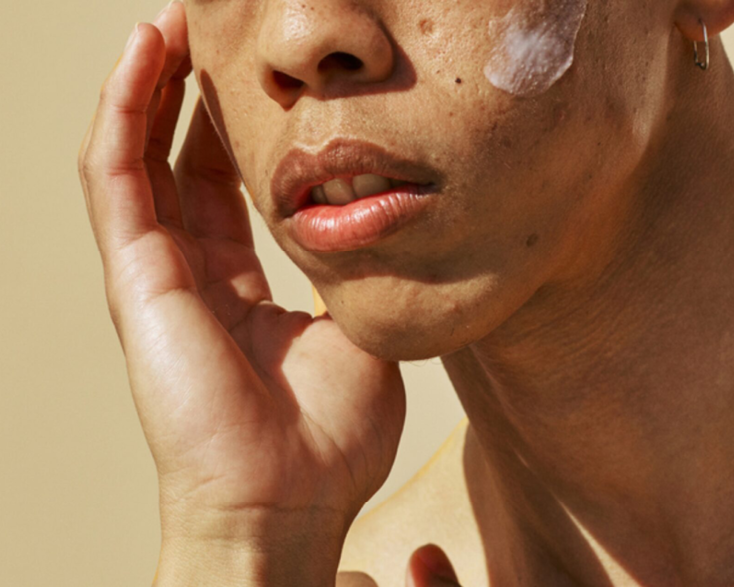 Have Cystic Acne? Skincare Library article