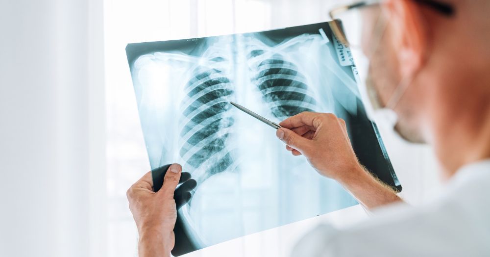 How Do I Know if My Chest Infection is Viral or Bacterial? CareCard