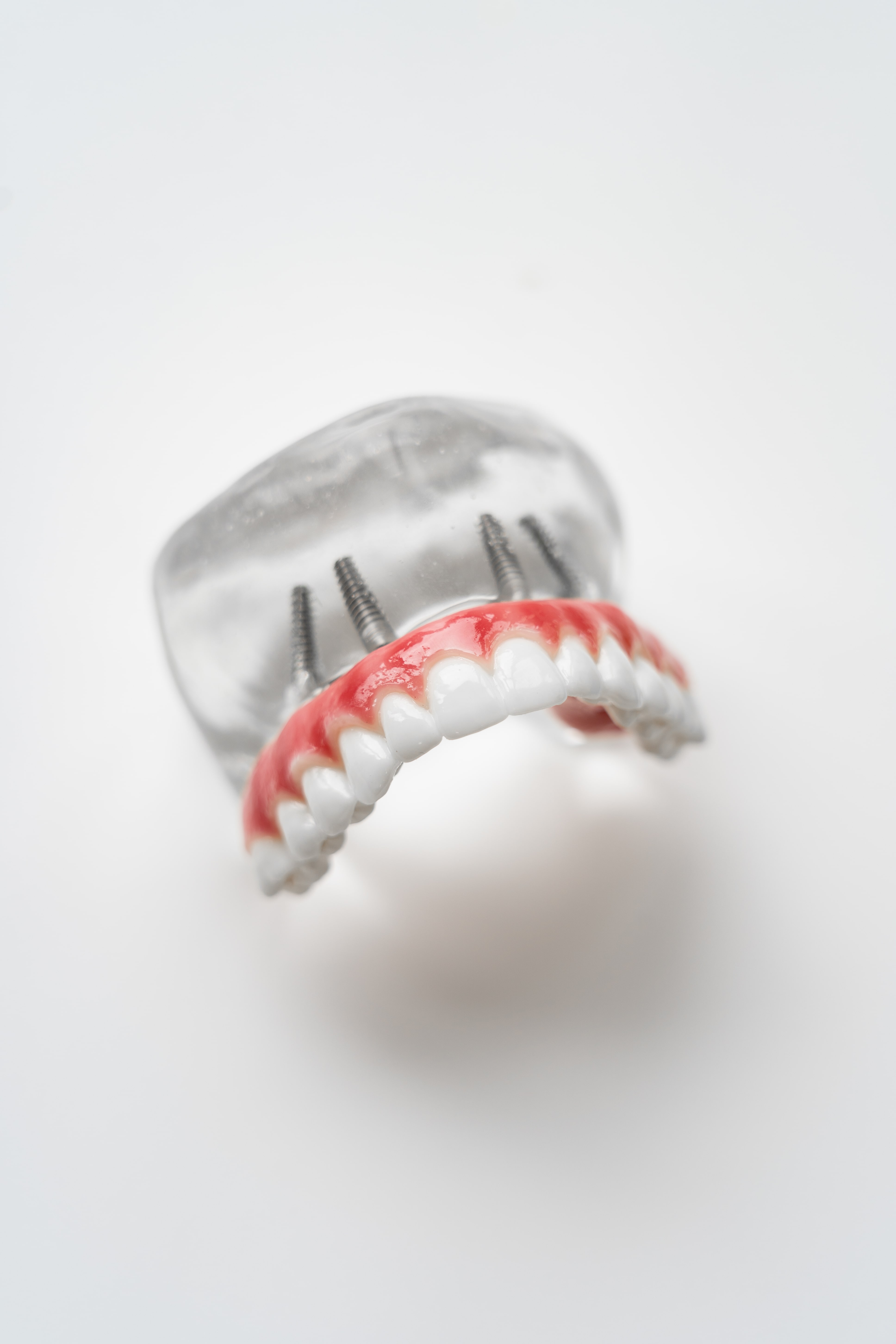 Implantology 4