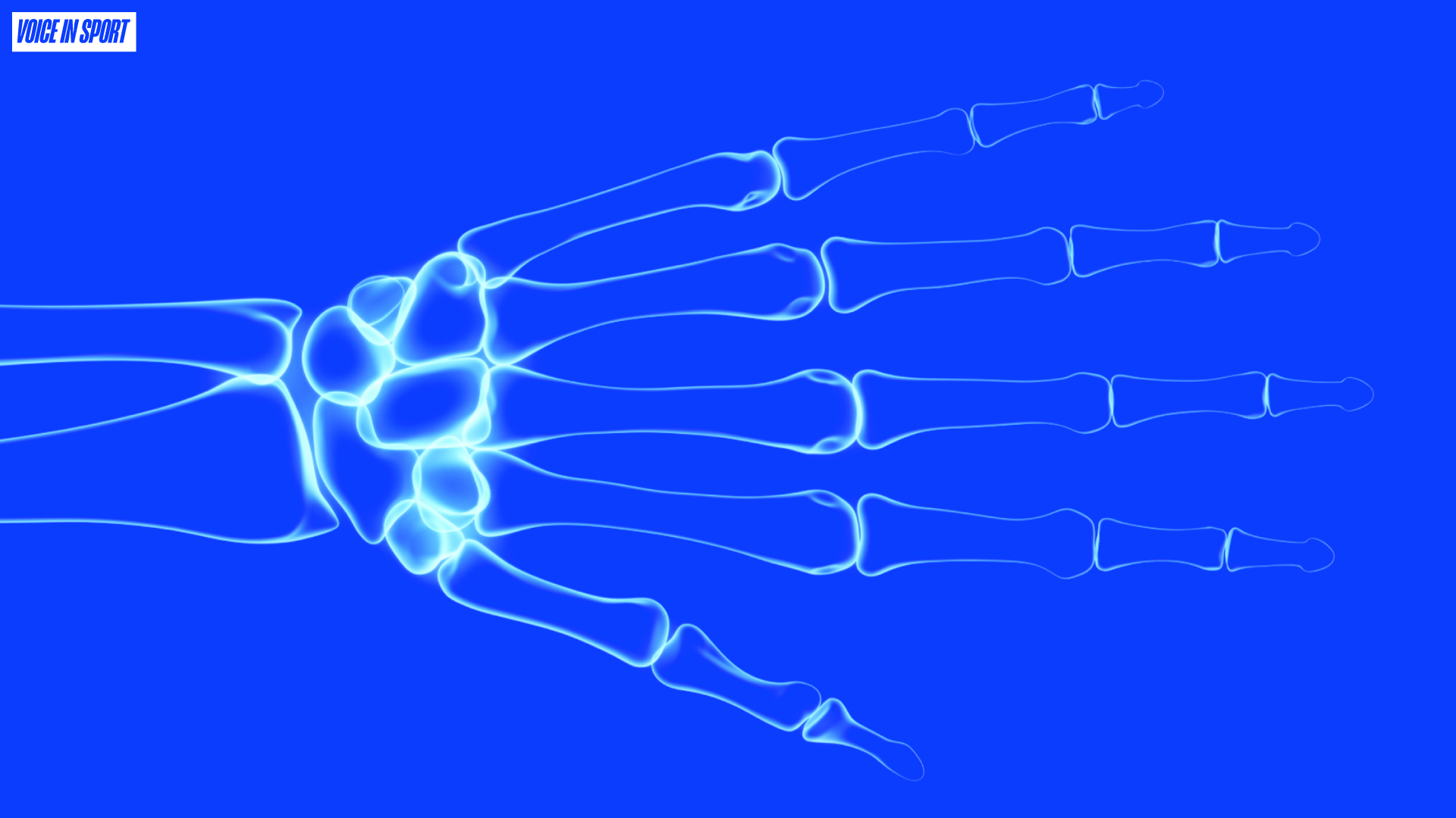 VIS BONE STRESS INJURIES FEED