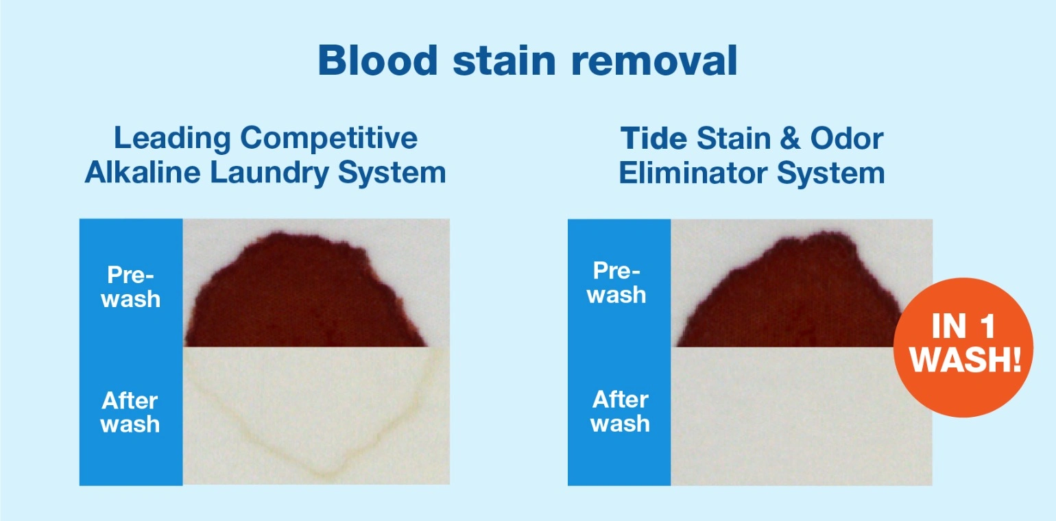 Remove Blood and Stains with Tide ® Professional Stain & Odor Eliminator